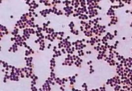 Τι είναι ο Staphylococcus aureus;